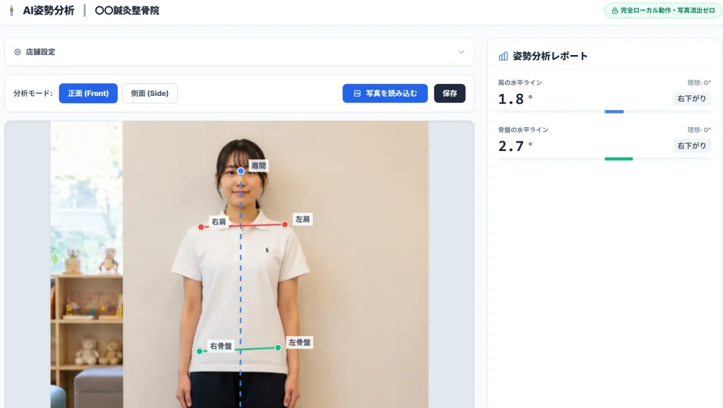 AI姿勢分析ツールで出力された、骨格のラインや歪みの角度が数値化されたレポート画像のイメージ
