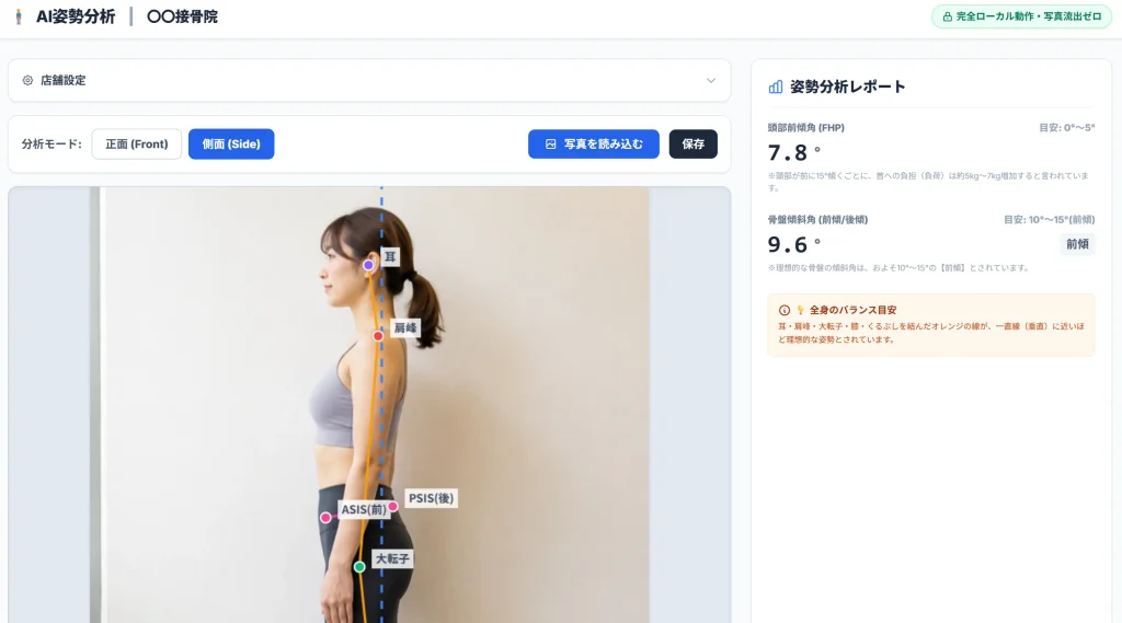 AI姿勢分析ツールで患者の写真を読み込み、骨格マーカーと歪みの角度が表示されている操作画面