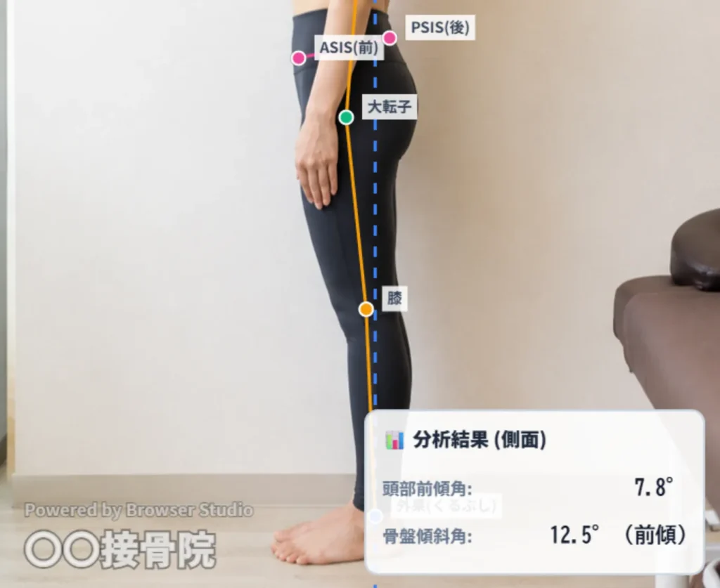 院名（屋号）の透かしを入れてレポート画像を保存できる様子